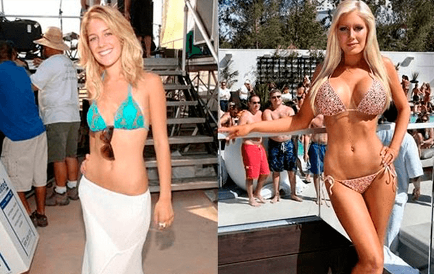 10 Celebrities Who Got Breast Augmentation and Looked Stunning