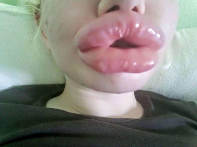 Болгарская девушка с самыми большими губами в мире (21 фото)