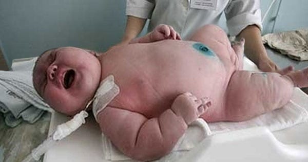 В Австралии родился ребёнок весом 18 кг ! ! !