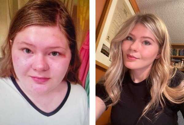 41 фотография до и после похудения. Невероятные преображения